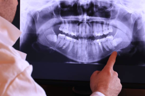 Best Pediatric Emergency Dentist in Linganore, MD