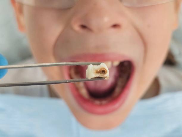 Best Orthodontic Emergency Dentist in Linganore, MD